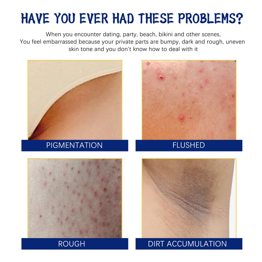 Body Whitening Cream, Lightening Dull Skin Even Skin Tone Moisturizing Skin Beauty Cream
