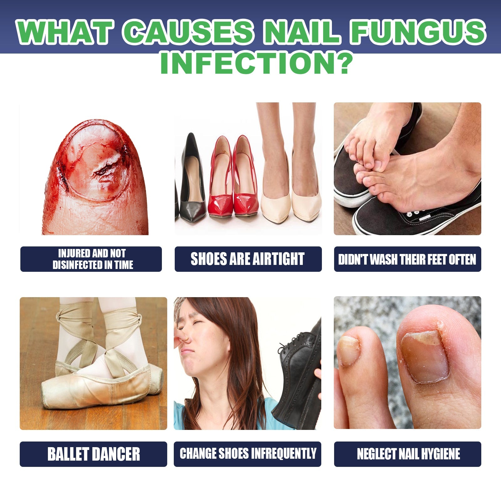 Gray Nail Repair Drops, Repair Hand And Foot Gray Nails Soft And Bright Nail Thickening Nail Care Solution